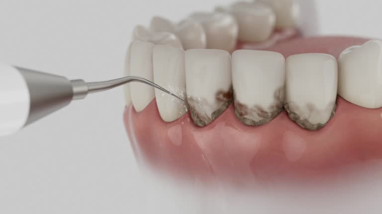 Reliable Dental contractor in Caldwell, OH by Dentist Open Now